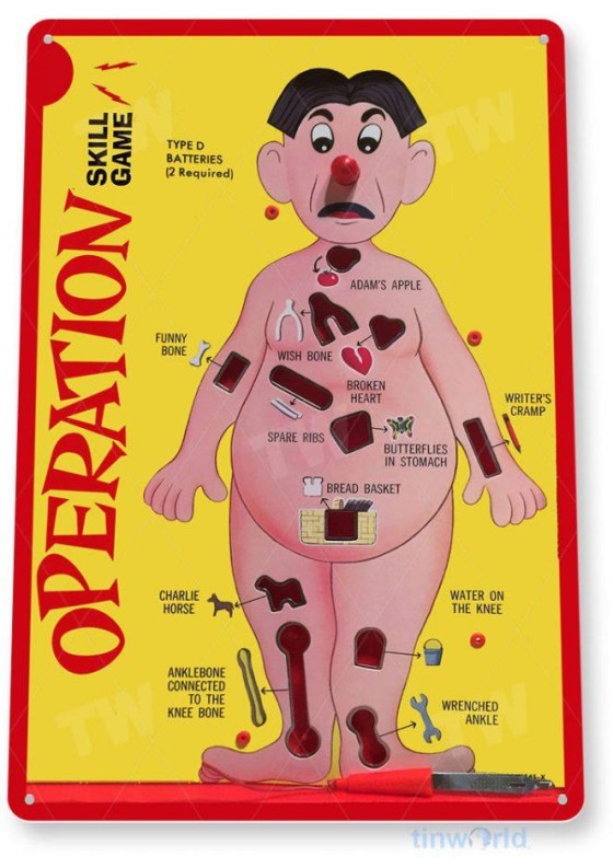 The board game Operation, an electronic game in which players attempt to remove plastic ailments without touching the sides of the small wells they are placed in.